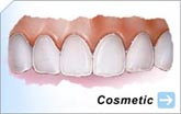 Bonding | Enamel Reshaping | Orthodontics | Tooth Whitening | Veneers